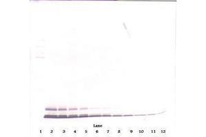 Image no. 1 for anti-Chemokine (C-C Motif) Ligand 5 (CCL5) antibody (ABIN465680) (CCL5 抗体)