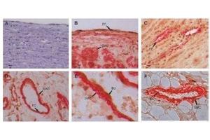 Immunohistochemistry (Paraffin-embedded Sections) (IHC (p)) image for anti-Gremlin 1 (GREM1) (AA 101-184) antibody (ABIN687082)