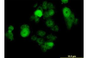 Immunofluorescence of monoclonal antibody to SOX30 on MCF-7 cell. (SOX30 抗体  (AA 644-753))