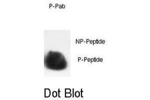 Dot blot analysis of HIST1H3B3 (phospho S10) polyclonal antibody  on nitrocellulose membrane. (Histone H3.1 抗体  (pSer10))