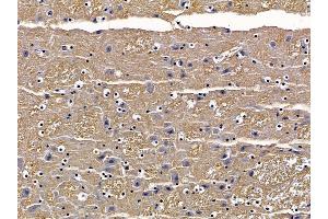 ABIN6257419 and ABIN6273804 at 1/100 staining mouse brain tissue by IHC-P. (PRKD3 抗体  (N-Term))