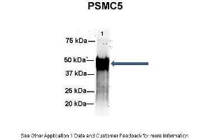 Amount and Sample Type :  500 ug mouse brain homogenate  Amount of IP Antibody :  6 ug  Primary Antibody :  PSMC5  Primary Antibody Dilution :  1:500  Secondary Antibody :  Goat anti-rabbit Alexa-Fluor 594  Secondary Antibody Dilution :  1:5000  Gene Name :  PSMC5  Submitted by :  Dr. (PSMC5 抗体  (C-Term))