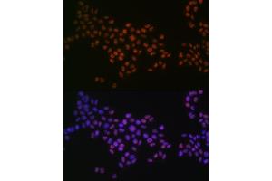 Immunofluorescence analysis of HeLa cells using GRB2 Rabbit mAb (ABIN7267518) at dilution of 1:100 (40x lens).