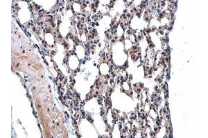 IHC-P Image MPP3 antibody [N1C1] detects MPP3 protein at cytoplasm and nucleus in mouse lung by immunohistochemical analysis.