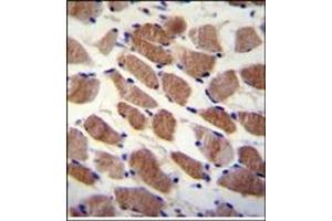 anti-Sterile alpha Motif Domain Containing 7 (SAMD7) (AA 209-238), (Middle Region) antibody
