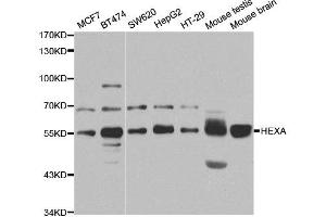 Western Blotting (WB) image for anti-Hexosaminidase A (HEXA) antibody (ABIN1876847) (Hexosaminidase A 抗体)