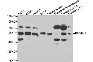 Western blot analysis of extracts of various cell lines, using RUVBL1 antibody. (RUVBL1 抗体)