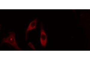 ABIN6275086 staining Hela cells by IF/ICC. (DZIP3 抗体  (Internal Region))