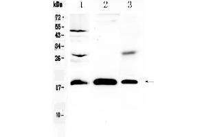 Western blot analysis of TMEM240 using anti- TMEM240 antibody . (TMEM240 抗体  (AA 1-173))