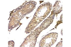 IHC analysis of WWOX using anti-WWOX antibody (ABIN6719627). (WWOX 抗体  (AA 1-245))