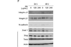 PB downregulates several proteins related to cell cycle progression, morphology, cell-cell adhesion and cell migration. (SNAIL 抗体)