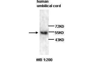 Western blot analysis of human umbilical cord lysates, using VEGF antibody.