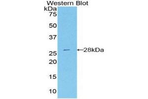 Western Blotting (WB) image for anti-DEAD (Asp-Glu-Ala-Asp) Box Polypeptide 58 (DDX58) (AA 1-211) antibody (ABIN3206479) (DDX58 抗体  (AA 1-211))