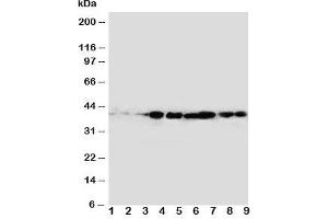 Western blot testing of CrkL antibody and rat samples 1: spleen;  2: ovary;  3: testis; and human samples 4: MM231;  5: A431;  6: MCF-7;  Lane 7;  MM231;  8: MM543;  9: Jurkat cell lysate. (CrkL 抗体  (AA 286-303))