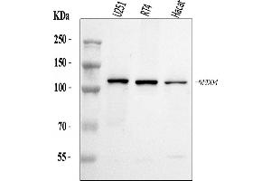 Western blot analysis of NEDD4 using anti-NEDD4 antibody (ABIN7599536).