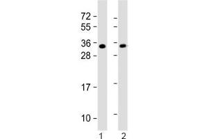 Western blot testing of 1) mouse heart and 2) rat PC-12 lysate with SLUG antibody. (SLUG 抗体  (AA 98-129))