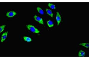 Immunofluorescent analysis of A549 cells using ABIN7167605 at dilution of 1:100 and Alexa Fluor 488-congugated AffiniPure Goat Anti-Rabbit IgG(H+L) (RGS2 抗体  (AA 1-241))