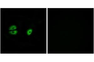 Immunofluorescence analysis of A549 cells, using MRPS22 Antibody. (MRPS22 抗体  (AA 231-280))