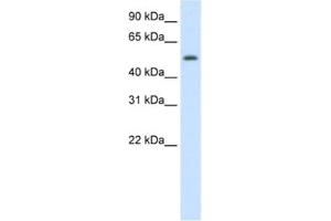 Western Blotting (WB) image for anti-Death Inducer-Obliterator 1 (DIDO1) antibody (ABIN2461922) (DIDO1 抗体)