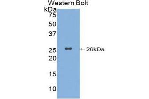 Western Blotting (WB) image for anti-Xeroderma Pigmentosum, Complementation Group C (XPC) (AA 734-933) antibody (ABIN1860965) (XPC 抗体  (AA 734-933))