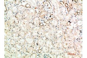 Immunohistochemical analysis of paraffin-embedded human-kidney, antibody was diluted at 1:200 (CTLA4 抗体  (AA 41-90))