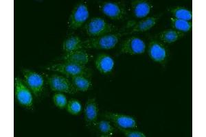IF analysis of FGG using anti-FGG antibody (ABIN7603146).