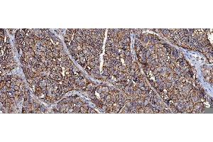 IHC analysis of CD147/Emmprin using anti-CD147/Emmprin antibody (ABIN7599998). (CD147 抗体  (AA 138-323))