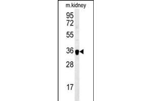 ILK Antibody (Center) 5884c western blot analysis in mouse kidney tissue lysates (35 μg/lane). (ILKAP 抗体  (AA 243-270))