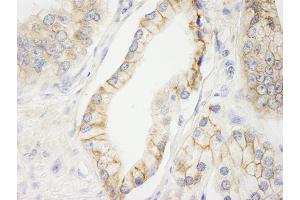 Immunohistochemistry (IHC) image for anti-C2 Calcium Dependent Domain Containing 5 (C2CD5) (AA 375-425) antibody (ABIN7448623) (C2CD5/KIAA0528 抗体  (AA 375-425))