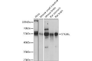 Western blot analysis of extracts of various cell lines, using STK38L Rabbit pAb (ABIN7270226) at 1:1000 dilution. (STK38L 抗体  (AA 165-464))