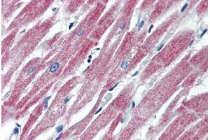 Human Heart (formalin-fixed, paraffin-embedded) stained with MAS1 antibody ABIN462250 followed by biotinylated goat anti-rabbit IgG secondary antibody ABIN481713, alkaline phosphatase-streptavidin and chromogen. (MAS1 抗体  (AA 187-236))