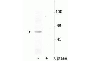 Western blot of rat brain nuclear fraction lysate showing specific immunolabeling of the ~53 kDa p53 phosphorylated at Ser392 in the first lane (-). (p53 抗体  (pSer392))