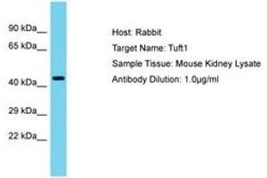 Image no. 1 for anti-Tuftelin 1 (TUFT1) (AA 201-250) antibody (ABIN6750538) (TUFT1 抗体  (AA 201-250))