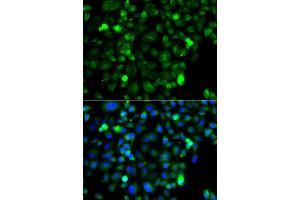 Immunofluorescence analysis of A549 cell using ZAK antibody. (ZAK 抗体)