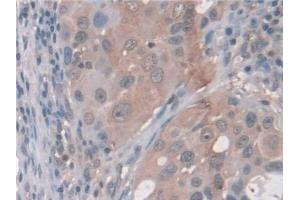 Immunohistochemistry (IHC) image for anti-Aminoadipate Semialdehyde Synthase (AASS) (AA 33-455) antibody (ABIN7444178)
