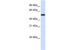 WB Suggested Anti-DCP2 Antibody Titration:  0. (DCP2 抗体  (Middle Region))