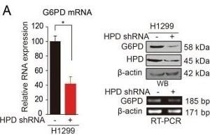HPD contributes to cell proliferation through upregulation of G6PD. (HPD 抗体)