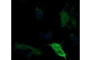 Image no. 1 for anti-Mitogen-Activated Protein Kinase Kinase 1 (MAP2K1) antibody (ABIN1499375) (MEK1 抗体)