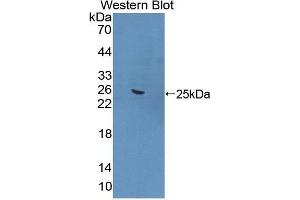 Western Blotting (WB) image for anti-Formin Binding Protein 1 (FNBP1) (AA 348-529) antibody (ABIN1868017) (FNBP1 抗体  (AA 348-529))