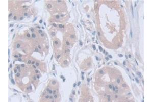 Detection of CAPNS1 in Human Stomach Tissue using Polyclonal Antibody to Calpain, Small Subunit 1 (CAPNS1)