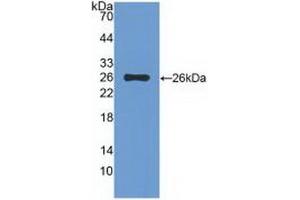 Detection of Recombinant TIGIT, Rat using Polyclonal Antibody to T-Cell Immunoreceptor With Ig And ITIM Domains Protein (TIGIT) (TIGIT 抗体  (AA 28-227))
