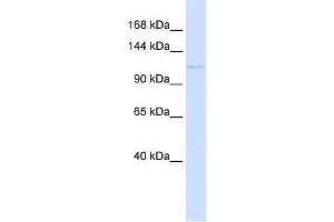PTCH2 antibody used at 1 ug/ml to detect target protein. (Patched 2 抗体)