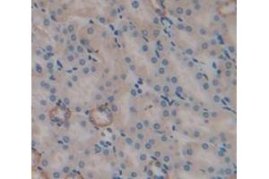 Immunohistochemistry (IHC) image for anti-Tumor Necrosis Factor (Ligand) Superfamily, Member 10 (TNFSF10) (AA 40-291) antibody (ABIN1172422)