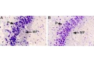 Expression of NGF in rat brain - Immunohistochemical staining of rat hippocampal mossy fiber terminal zone using Anti-NGF Antibody (#AN-240). (Nerve Growth Factor 抗体  (Intracellular))