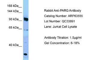 Western Blotting (WB) image for anti-PARG (PARG) (C-Term) antibody (ABIN2789543) (PARG 抗体  (C-Term))