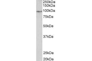 ABIN5539878 2µg/ml) staining of Human Uterus lysate (35µg protein in RIPA buffer). (PDE4B 抗体  (C-Term))