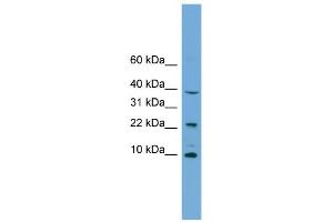 WB Suggested Anti-CHCHD8 Antibody Titration: 0. (COA4 抗体  (Middle Region))