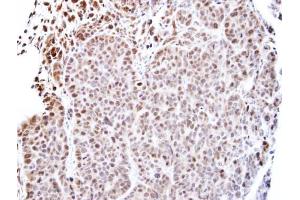 IHC-P Image Immunohistochemical analysis of paraffin-embedded SW480 xenograft, using TEAD4, antibody at 1:500 dilution. (TEAD4 抗体  (Center))