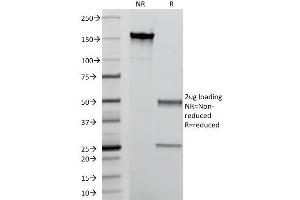 SDS-PAGE Analysis Purified Macrophage L1 Protein Mouse Monoclonal Antibody (MAC387).