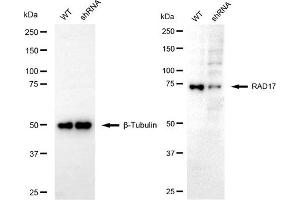 Western blotting analysis using RAD17 antibody (ABIN7800114). (RAD17 抗体)